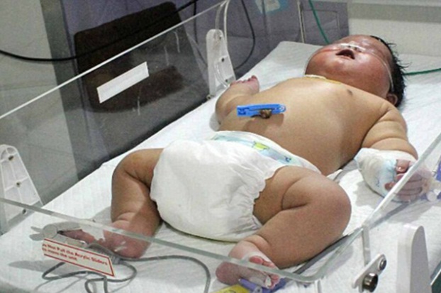 سنگین ترین نوزاد دنیا