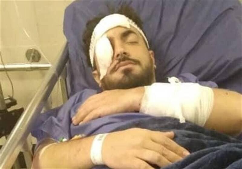 حمله به یک روحانی در تهرانپارس؛ انتقال به بیمارستان