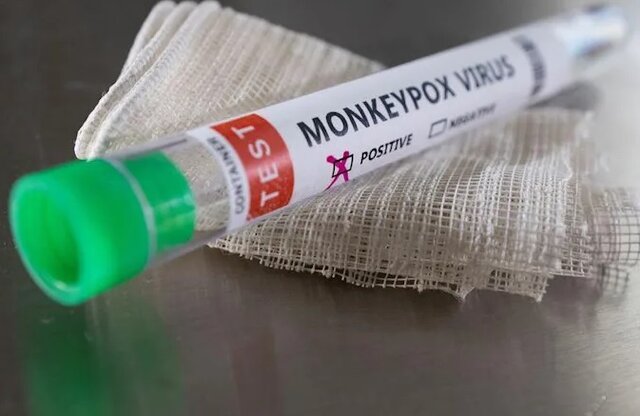 وزارت بهداشت: درخواست خرید واکسن علیه موارد احتمالی آبله میمونی