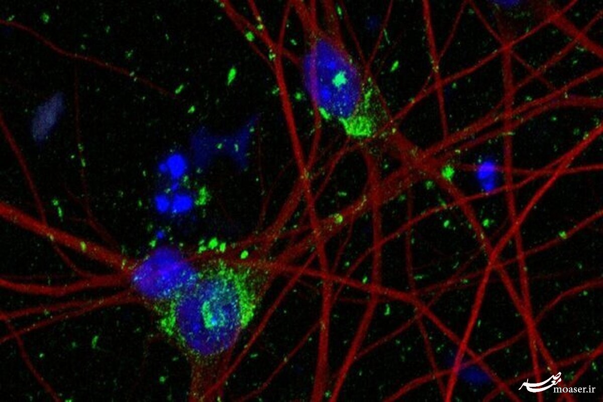 امید به درمان آلزایمر با مدل‌سازی جدید از نورون انسان