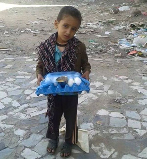 دست‌ فروشی کودک جنگ‌زده یمنی +عکس