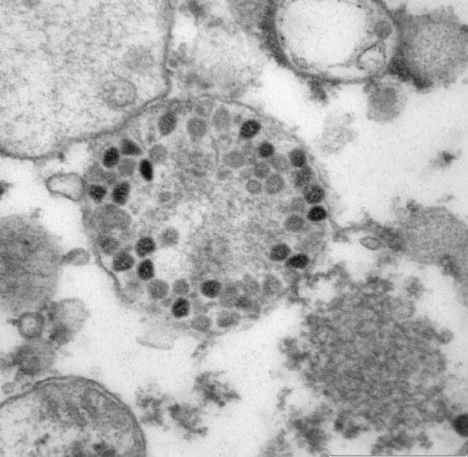 اولین تصویر از ویروس اُمیکرون