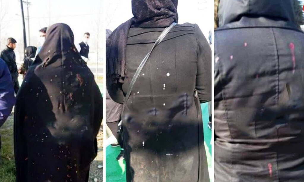 فوری: اسید پاشی در تهران|اسیدپاشی و زنان در شهرک مریم