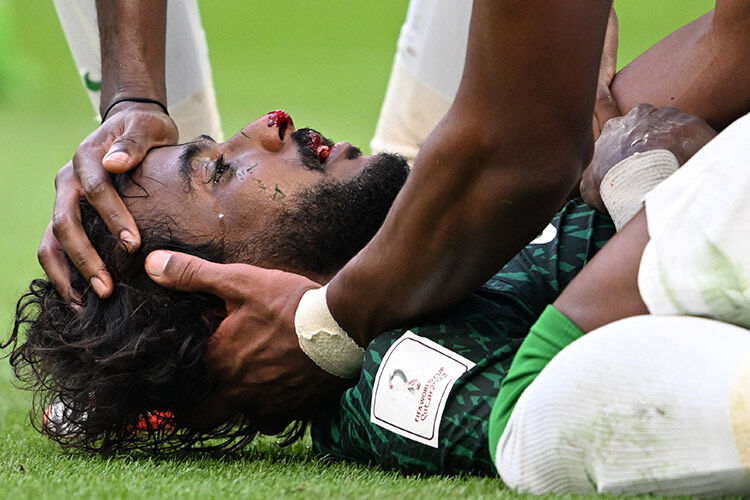 وداع تلخ الشهرانی با جام جهانی؛ مدافع عربستان با دستور بن‌سلمان به آلمان اعزام شد