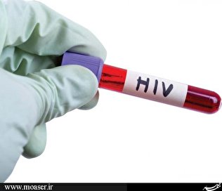 باید تا سال ۲۰۳۰ موارد جدید ابتلا به HIV به صفر کاهش یابد